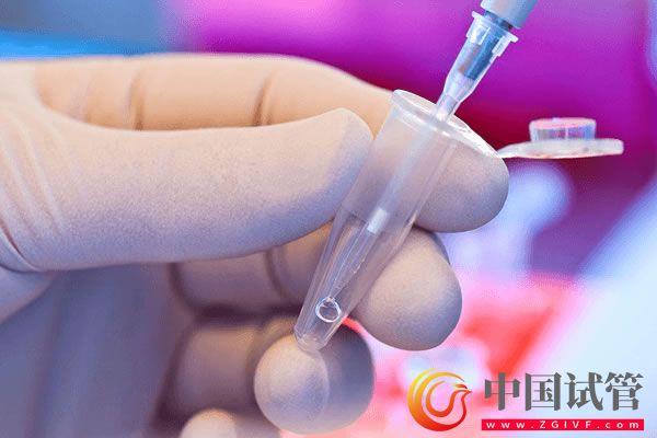 第四代试管婴儿(图5) 第四代试管婴儿(图5)