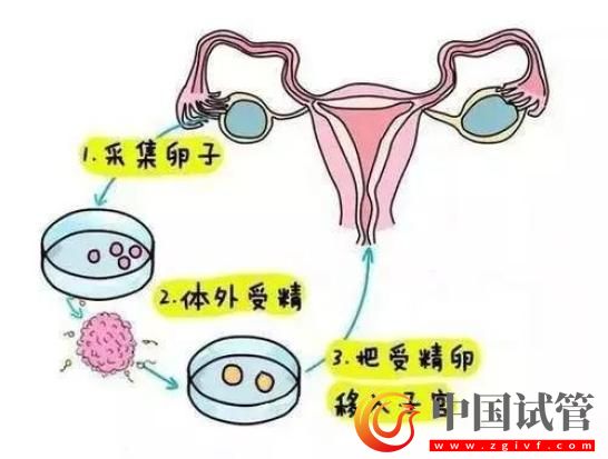 新伟德国际1496备用婴儿技术发布！专家：每年可多生10万以上婴儿(图3)