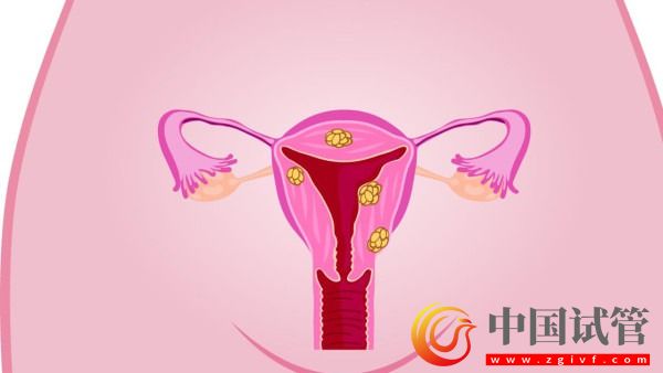 北京宫颈癌与乳腺癌早诊治疗率接近100%(图1)