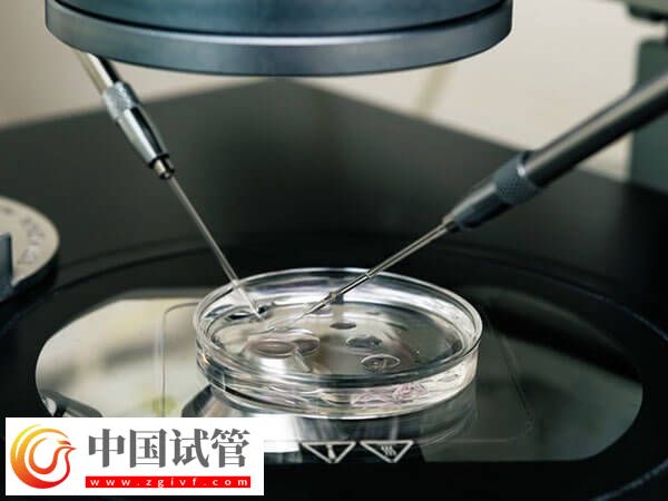 重庆市妇幼保健院助孕生龙凤胎成本高不高?全程至少5w(图2) 重庆市妇幼保健院助孕生龙凤胎成本高不高?全程至少5w(图2)