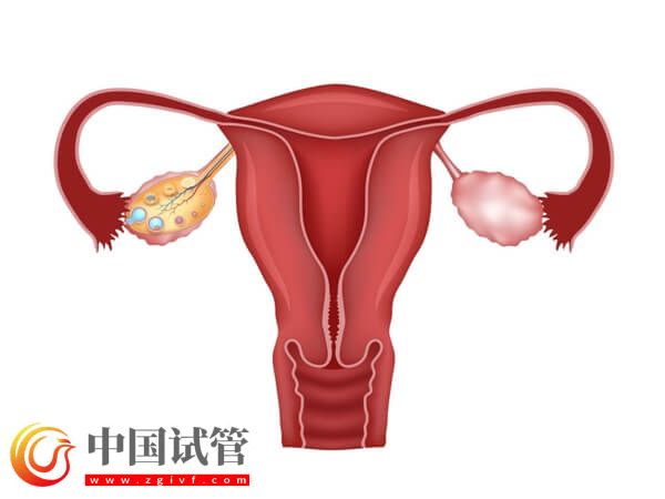 没有子宫能生孩子吗(图8) 没有子宫能生孩子吗(图8)