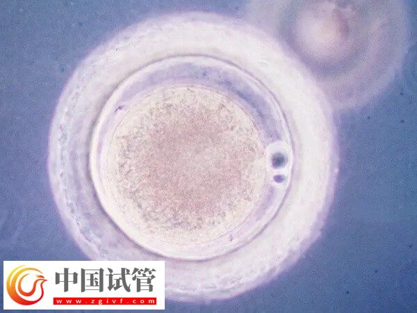 哪些人可以做胚胎辅助孵化(图1) 哪些人可以做胚胎辅助孵化(图1)