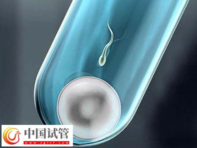 常州试管婴儿成功率多少(图1) 常州试管婴儿成功率多少(图1)