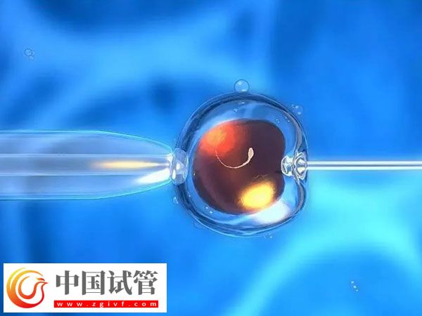 杭州省妇保医院和市一医院做试管哪个好(图2)