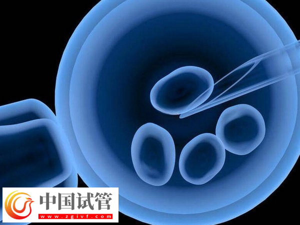 杭州省妇保医院和市一医院做试管哪个好(图3)