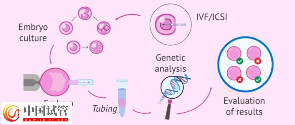 基因与第三代试管婴儿的结合