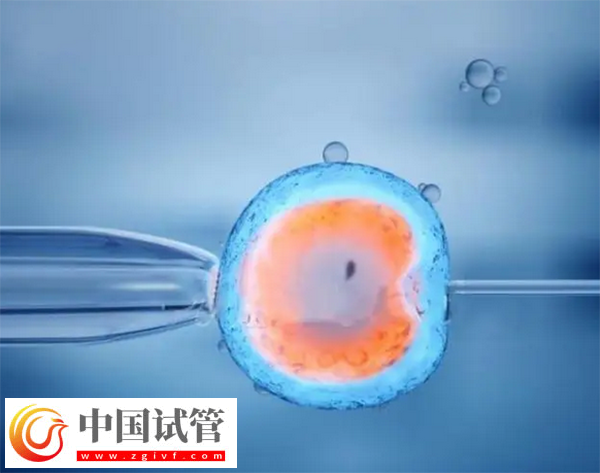 上海试管婴儿成功率(图1) 上海试管婴儿成功率(图1)