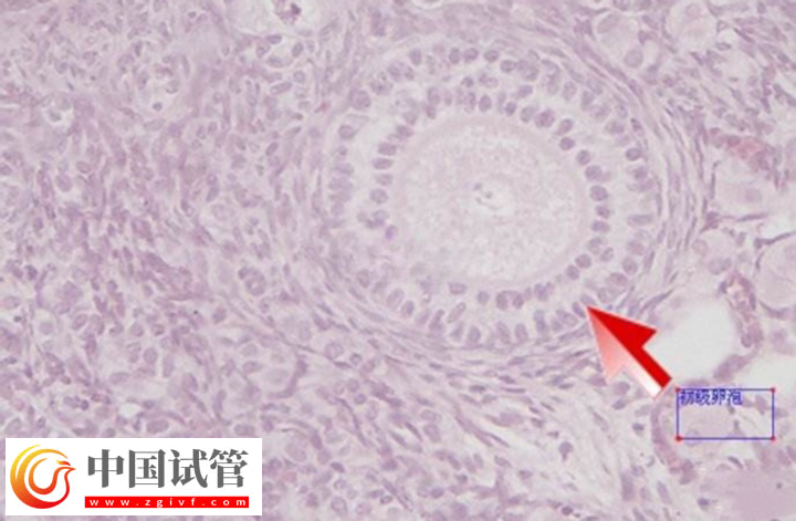 在美国做试管卵泡监测几次能成功(图2) 在美国做试管卵泡监测几次能成功(图2)
