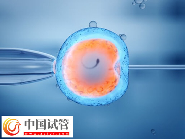 浙大一院试管婴儿好不好(图1)