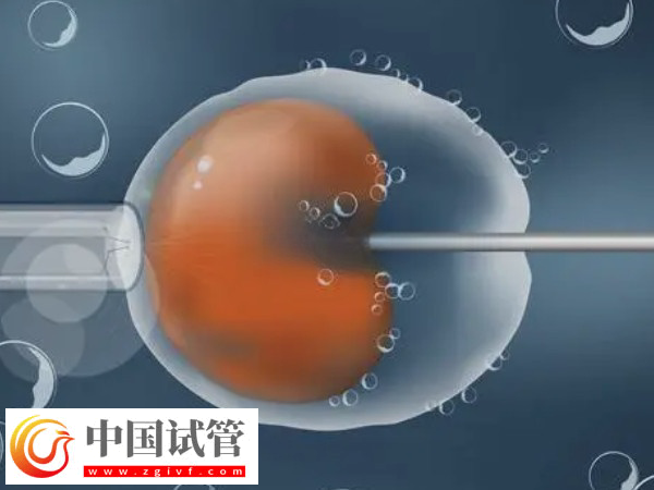 在义乌能不能做试管婴儿(图1)