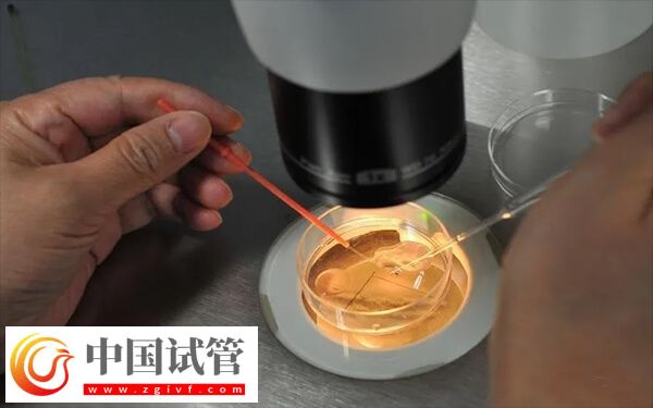 为什么医生不给移植鲜胚(图1) 为什么医生不给移植鲜胚(图1)