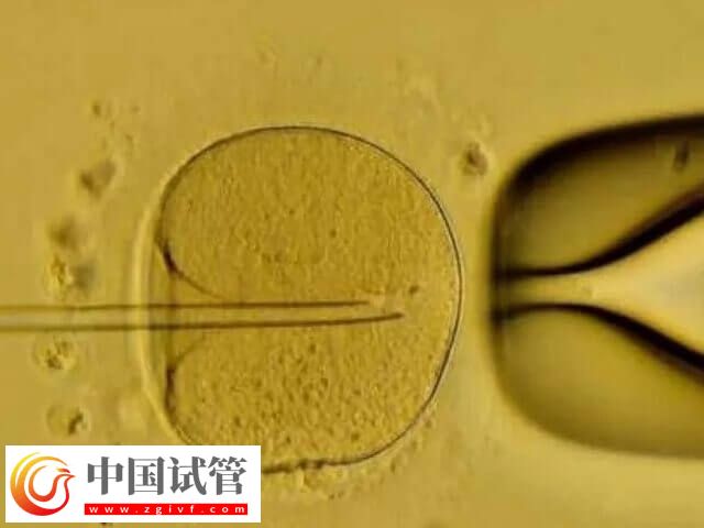 5天囊胚和3天鲜胚有哪些区别(图2)