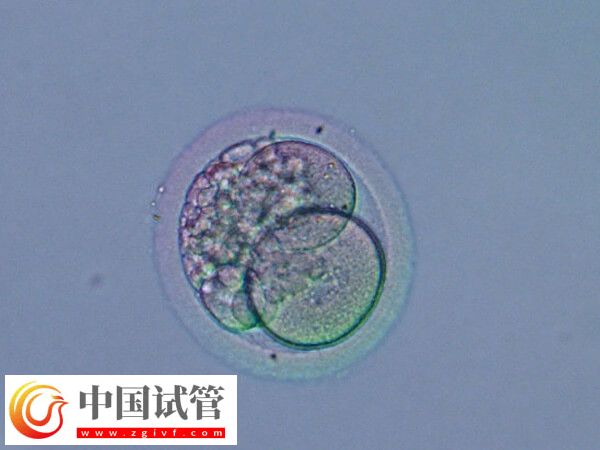 鲜胚与囊胚有什么不同(图1)
