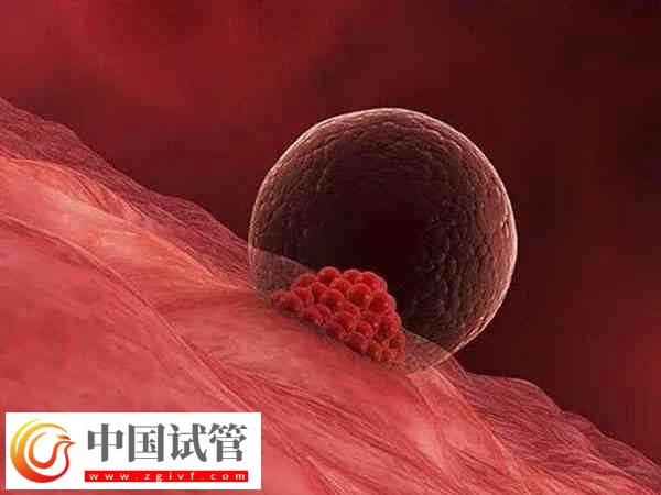 胚胎移植后会不会出现胎停(图2) 胚胎移植后会不会出现胎停(图2)