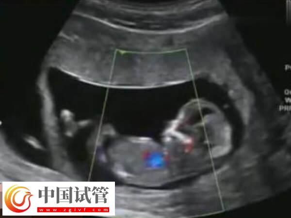 胚胎移植过后要注意这6点，饮食调理、定期产检都在其中(图2)