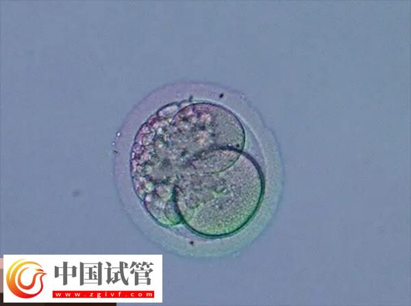 做试管月经不规律的移植方案分享,激素替代周期为其一(图2) 做试管月经不规律的移植方案分享,激素替代周期为其一(图2)