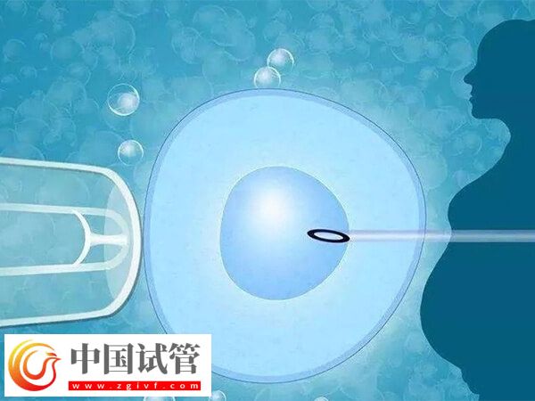 年龄大五个卵泡做几代试管(图2)