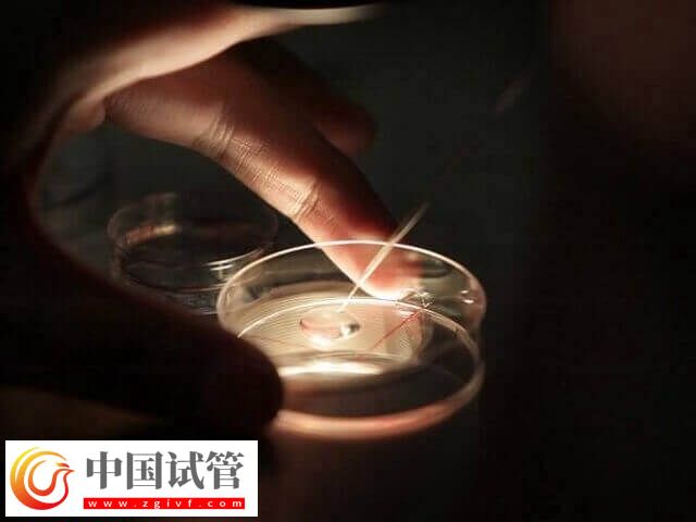 高龄是不是适合养囊胚(图2) 高龄是不是适合养囊胚(图2)