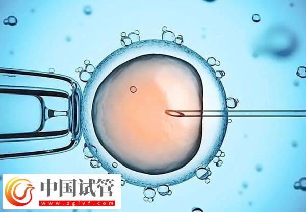 长沙开展辅助生殖技术医院中助孕成功率高的有哪些?(图2) 长沙开展辅助生殖技术医院中助孕成功率高的有哪些?(图2)